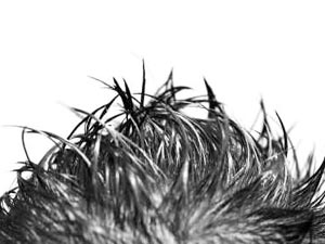 Decrease Greasy Hair Build up..?