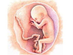 Importance Umblical Cord Aid0181