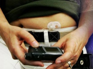 Symptoms of Late Stage Diabetes Symptoms of Late Stage Diabetes