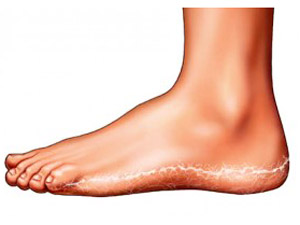 Diabetes and Skin Care