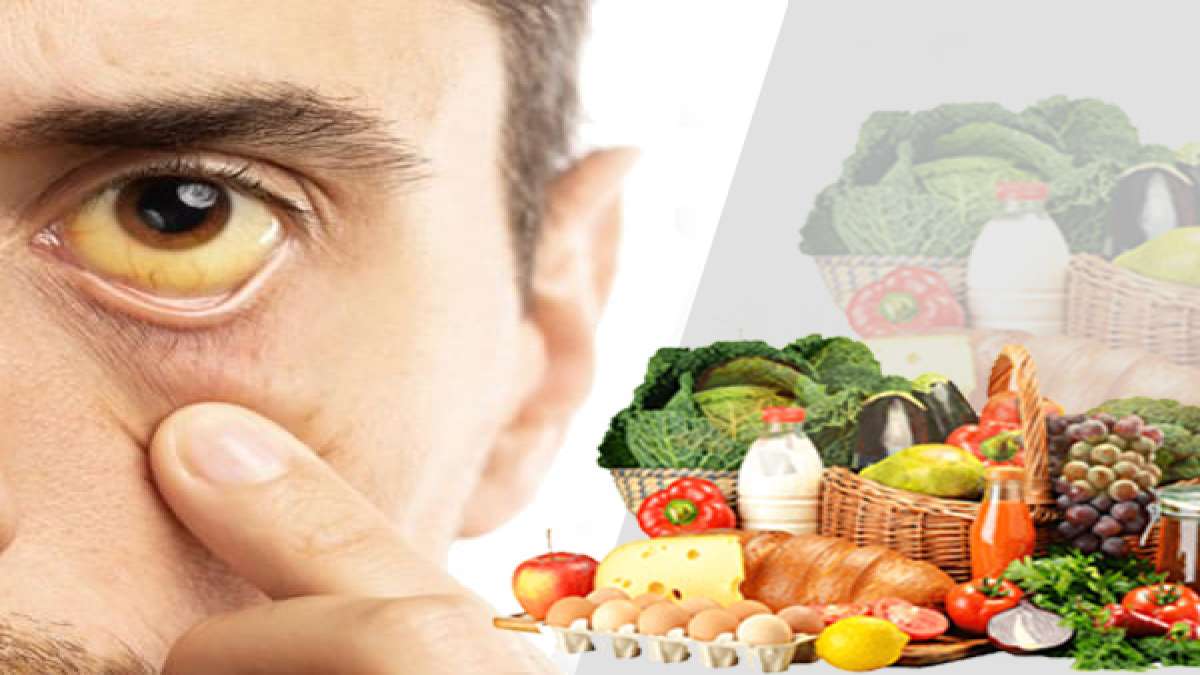 diet-for-jaundice
