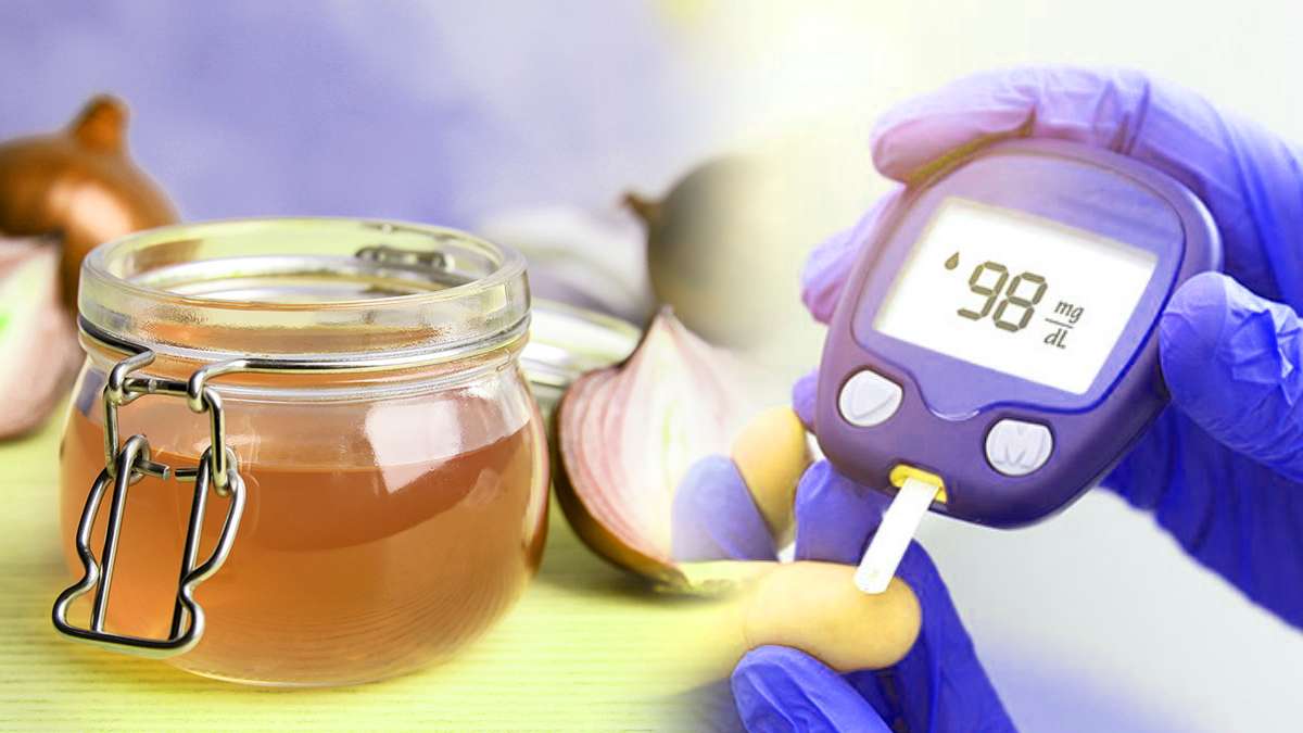 మధుమేహ వ్యాధిగ్రస్తులు రోజూ ఉల్లిపాయ రసం తాగితే షుగర్ లెవల్స్ అదుపులో ఉంటుంది Benefits of