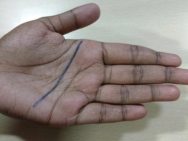 గొలుసులు విధి రేఖ
