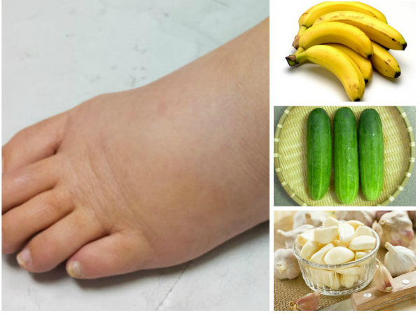  10 10 Quick Natural Remedies To Reduce Water 