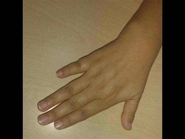 మీ చిటికెన వేలు పొట్టిదా?