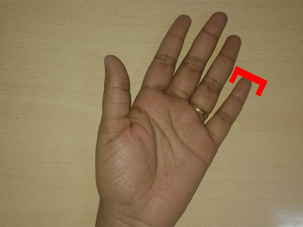 మీ చిటికెన వేలు చతురస్రంగా ఉంటే?