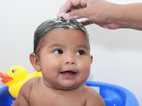 చర్మశోథి (cradle cap) :