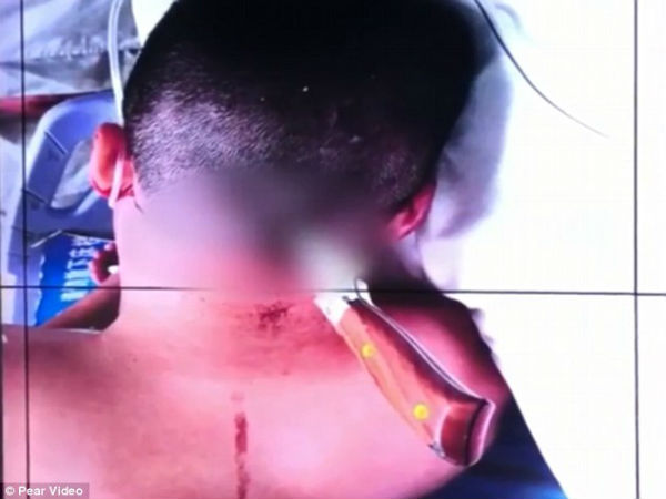 8 సెంటీమీటర్ల వరకు కత్తి