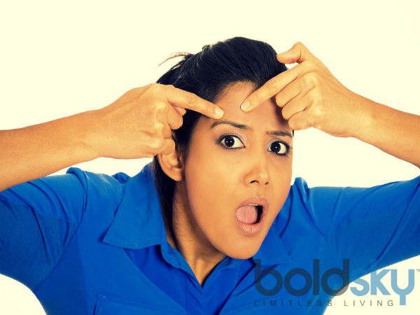 మొటిమల చికిత్సకు :-