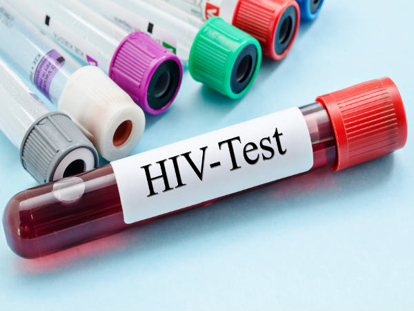 అపోహ 4: HIV మరియు AIDS ఒకే విషయం కాదు