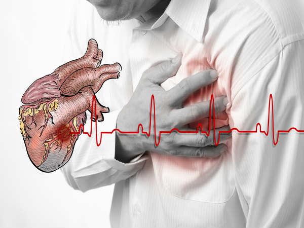 గుండెపోటు లక్షణాలు