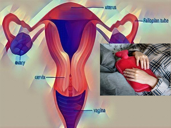 ఎండోమెట్రియోసిస్