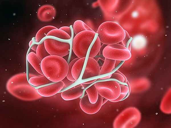 రక్తం గడ్డకట్టడం తగ్గించడం