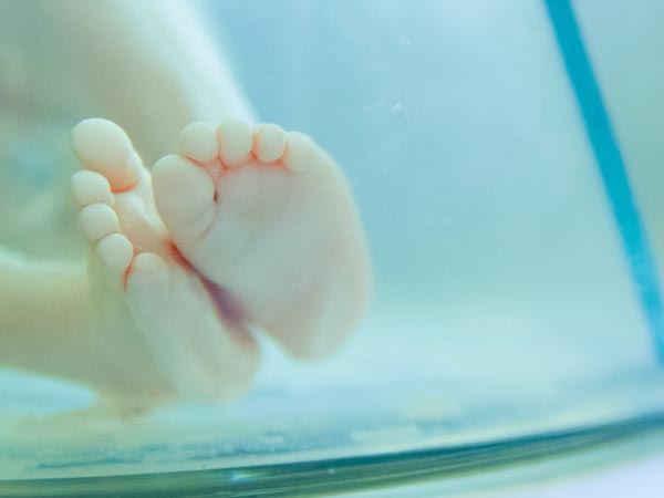 గర్భస్రావం కోసం ప్రమాద కారకాలు