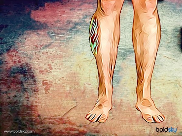 కాళ్ళలో కనిపించే వాపు