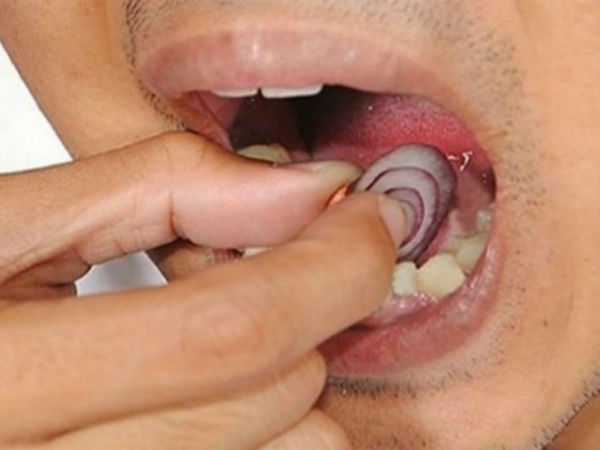 ఉల్లిపాయలు