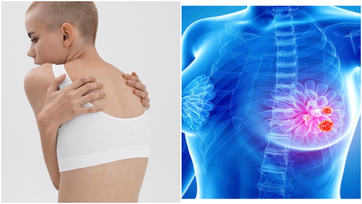 Breast Cancer Is Behind Your Back Shocking Factor In The Study Comes To Light