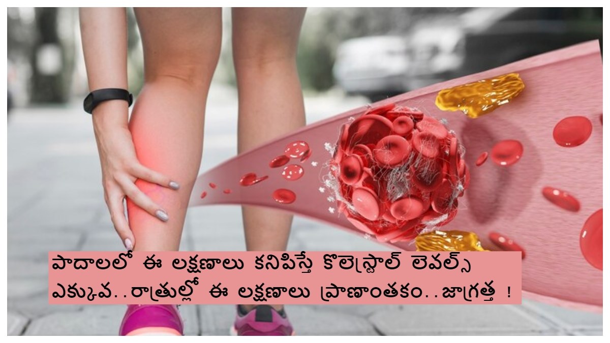 పాదాలలో అధిక కొలెస్ట్రాల్ లక్షణాలు..!ఈ లక్షణాలు ఏమాత్రం విస్మరించినా